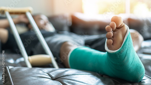 Cuadros en Lienzo Bone fracture foot and leg on male patient with splint cast and crutches during