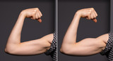 A before and after view on the arm of a young Caucasian woman. Showing toned biceps after spending time at the gym and working out.