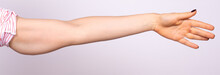 A Close Up View On The Arm Of A Young Woman, Isolated Against A White Background. She Holds Arm Out To Side, Revealing A Saggy Area Of Loose Skin And Fat Beneath The Triceps.