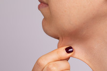 A Close-up And Side Profile View Of A Thirty Something Caucasian Lady Pinching The Loose Skin At The Front Of Her Throat. Commonly Called A Turkey Neck And Corrected With A Platysmaplasty.