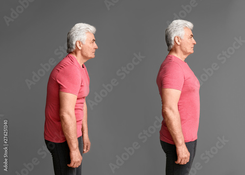 Fotomural Mature man with poor and good posture on grey background