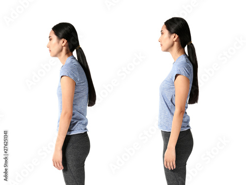 Fotografía Asian woman with poor and good posture on white background