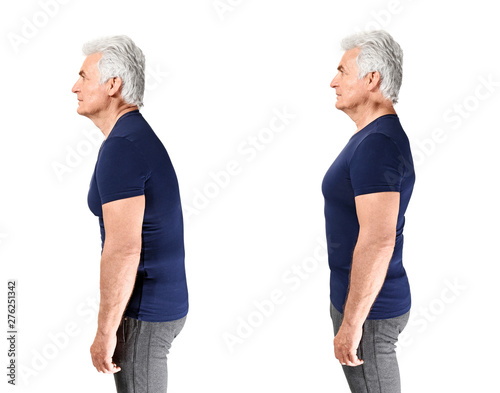 Fotografía Mature man with poor and good posture on white background