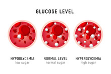Glucose Blood Level Sugar Test. Diabetes Insulin Hypoglycemia Or Hyperglycemia Diagram Icon