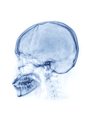 Poster - X-ray Skull Lateral View isolated on white Background