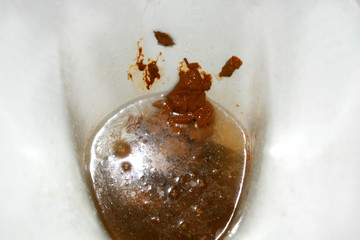 Toilet bowl with brown feces. The toilet soiled with excrement.