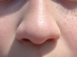 © natatretiakova - Nose teen girl close up front view