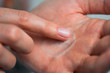 © Artem Markin - Fingers apply cream to skin. Close up