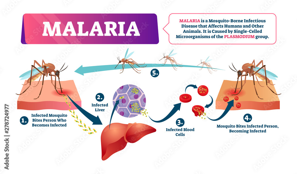 Malaria vector illustration. Mosquito bite blood infected disease - obrazy, fototapety, plakaty 