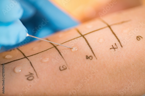 Fotografía Skin Prick Allergy Testing