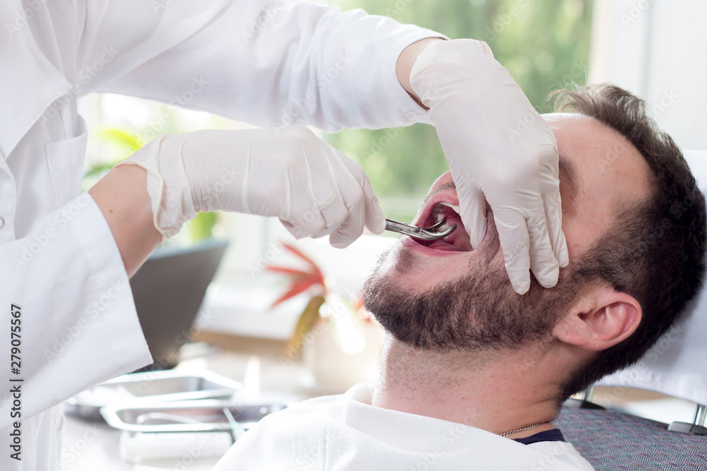 Biały mężczyzna siedzi na fotelu dentystycznym z szeroko otwartymi ustami. Dłonie stomatologa w białych rękawiczkach chwytają zęba kleszczami. - obrazy, fototapety, plakaty 