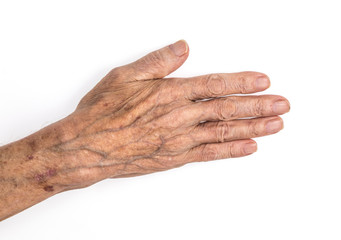 old man's sick hands on white background