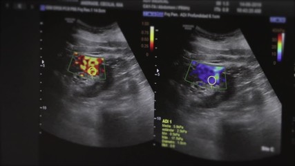 Ultrasound examination devices monitor close-up
