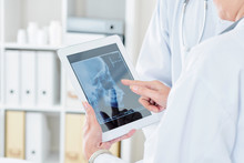Close-up Image Of Female Doctor Examining Scull X-ray On Screen Of Digital Tablet