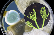 Penicillium Mold Fungi, 3D Illustration And Photo Of Colonies Grown On Nutrient Medium