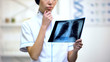 © motortion - Professional female therapist looking at lungs x-ray, thinking about diagnosis
