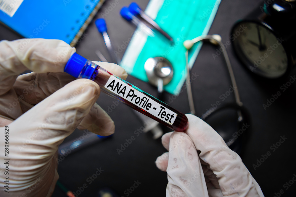 ANA Profile - Test with blood sample. Top view isolated on black ...