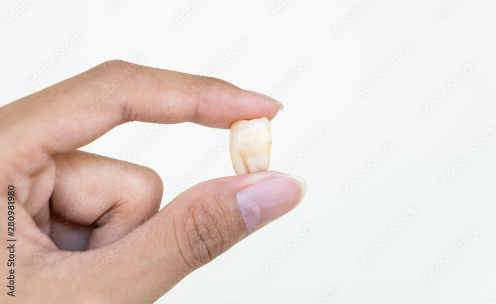 hand holding tooth Hand holding old removed wisdom tooth from kid mouth isolated on white  background, dentist found unhealthy damaged teeth cause toothache at  dentistry hospital Stock Photo | Adobe Stock