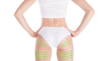 Female Attractive Buttocks In Base Underwear. Lifting Marking With Green Arrows In Womans Hips And Legs, Isolated On White.
