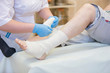 © Светлана Лазаренко - Nurse bandages the leg. Fracture of human lower limbs. Treatment of broken bones. Impose a gypsum. Patient surgical department. The doctor's hands tighten the bandage on his leg