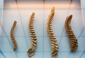 Wall Mural - Model of a human spine, spinal columns