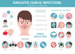 Nasal diseases. Sinusitis, sinus infection diagnosis and treatment medical infographic design