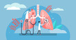 Pulmonology vector illustration. Flat tiny lungs healthcare persons concept