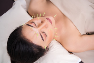 Sticker - woman undergoing acupuncture treatment on face