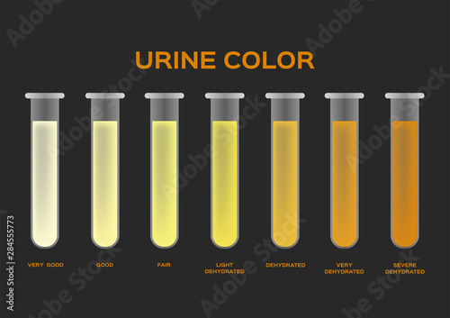Fotomural urine color vector / transparent yellow orange