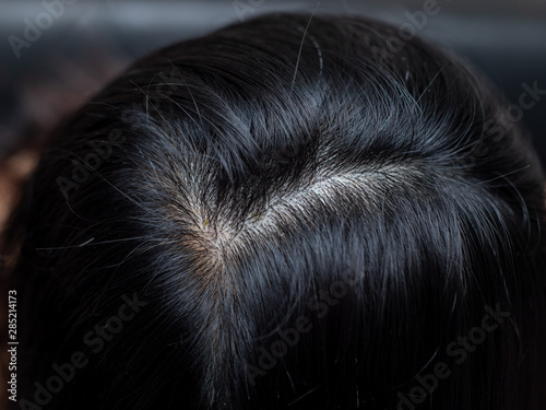 Young Woman Shows Her White Hair Roots Buy This Stock Photo And