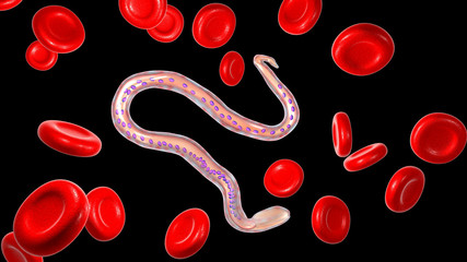 Wall Mural - Wuchereria bancrofti, a roundworm nematode, one of the causative agents of lymphatic filariasis, 3D illustration showing presence of sheath around the worm and tail niclei non-extending to tip