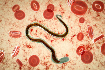 Wall Mural - Wuchereria bancrofti, a roundworm nematode, one of the causative agents of lymphatic filariasis, 3D illustration showing presence of sheath around the worm and tail niclei non-extending to tip