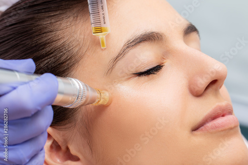Foto  Woman having micro needling treatment reducing crow's feet