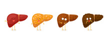 Stages Human Liver Character Damage Concept Set. Healthy Liver Steatosis Fatty NASH Fibrosis And Cirrhosis. Vector Cartoon Medical Reversible And Irreversible Condition Illustration