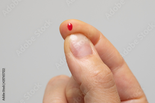 Fotografía A closeup view on the hand of a person squeezing blood out the end of a finger, prick test for diabetic monitoring, testing levels of glucose in the bloodstream