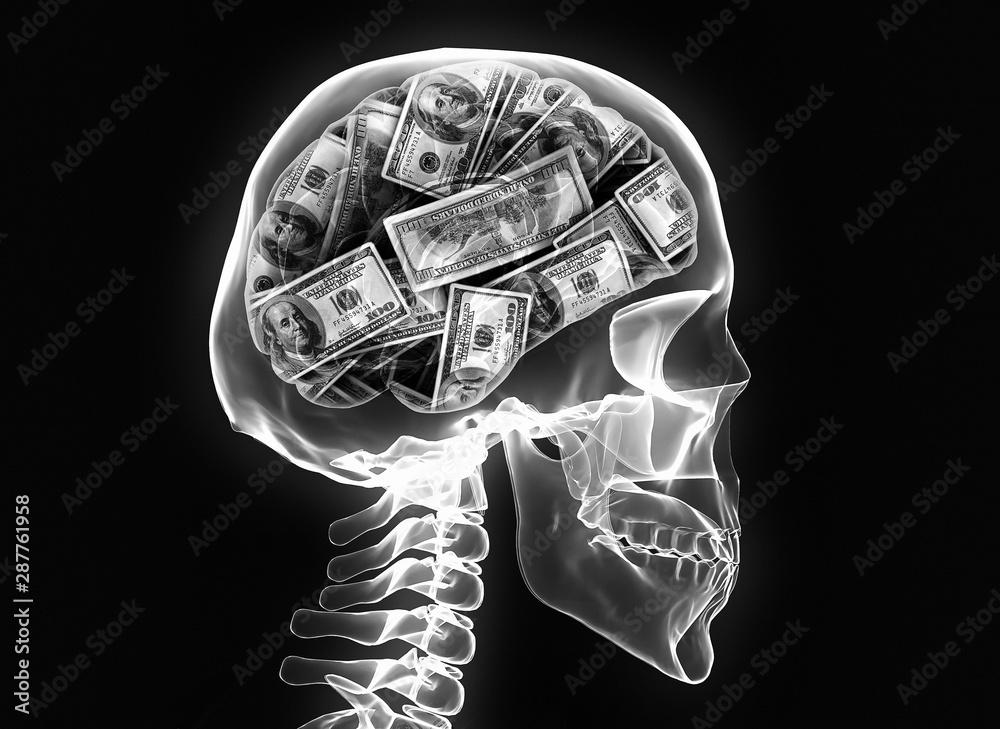 X-ray brain and skeleton - obrazy, fototapety, plakaty 