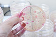 Colonies of bacteria in petri dish on the laboratory area.