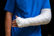 © photoguns - Man with broken arm wrapped medical cast plaster. Fiberglass cast covering the wrist, arm, elbow after sport accident, isolated on black