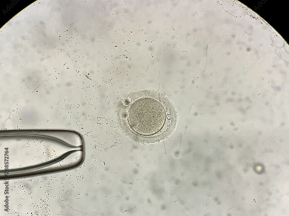 View through microscope at in vitro fertilization process Stock Photo ...