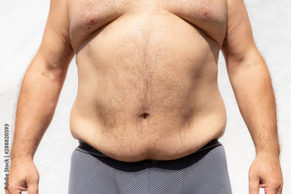 Heavy Torso The figure of an overweight mature man. Torso of a man in shorts Stock ...