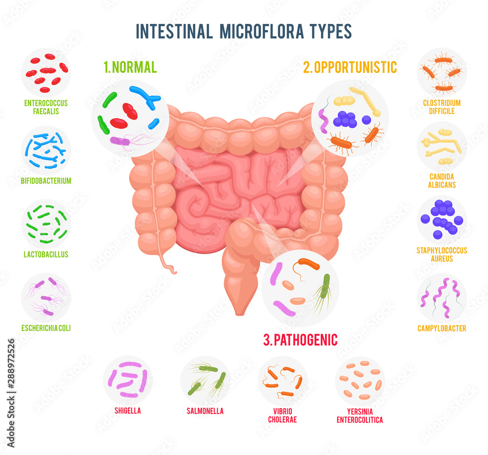 Realistic flat vector illustration of small and large intestine. Intestinal microbiota: normal flora, opportunistic flora and pathogenic flora. Good and bad bacteria. Microbiota types infographics. - obrazy, fototapety, plakaty 