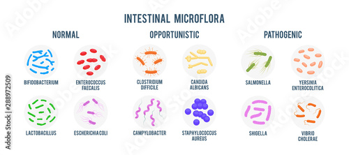 Cuadros en Lienzo Realistic flat vector illustration of small and large intestine