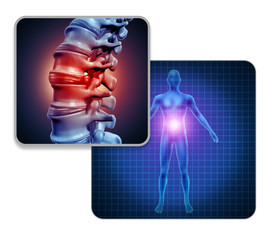 Wall Mural - Human Back Joint Pain