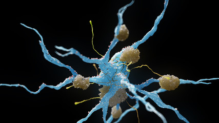 Wall Mural - 3d rendered medical illustration of nerve cells suffering from alzheimer disease