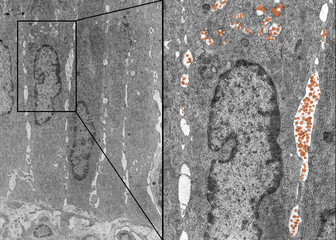 Sticker - Intestinal epithelium. Fat absorption