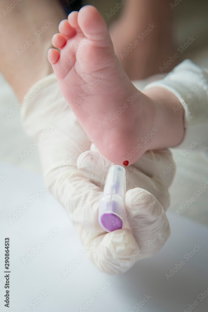 Fotografia Do Stock Nurse Performing The Neonatal Heel Prick Test fotografia-do-stock-nurse-performing-the-neonatal-heel-prick-test