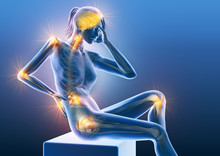 Rheumatoid Arthritis, Osteoarthritis, Painful Joints Of A Woman, Medically 3D Illustration