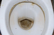 Dirty toilet close up. Soiled toilet.