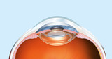 Fototapeta  - Human eye with artificial lens, lmedically 3D illustration