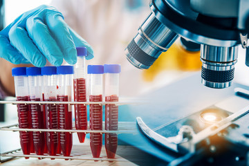 lab technician assistant analyzing a blood sample in test tube at laboratory with microscope. medica